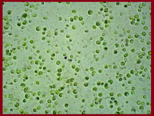 Chlorella vulgaris